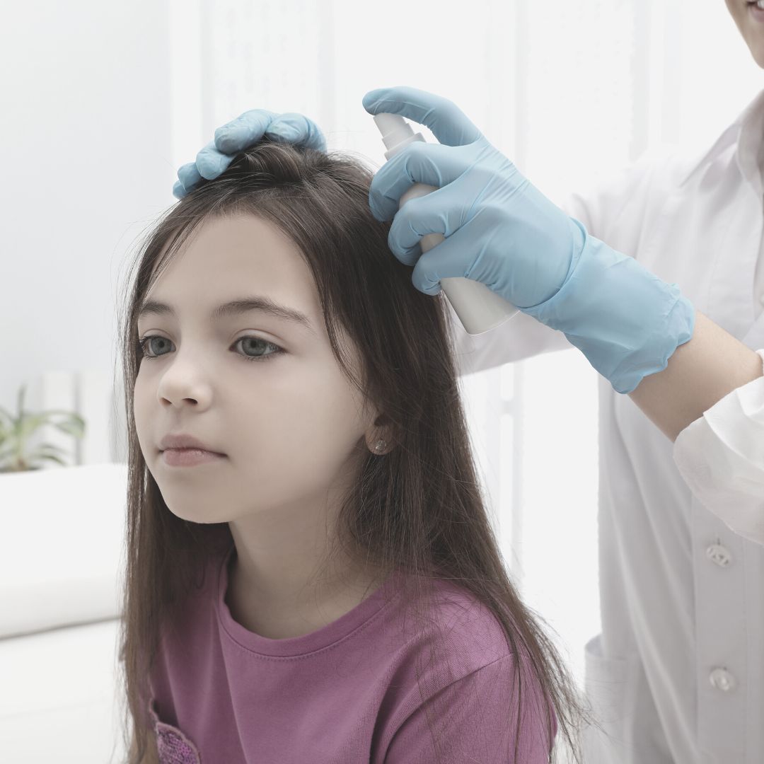 Lice Treatment - Champions Point Family Clinic
